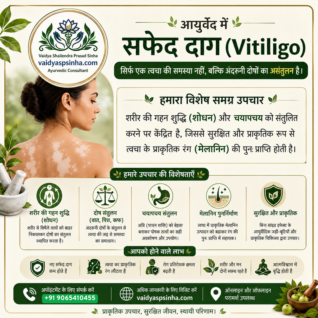 Safed Daag Ka Ayurvedic Ilaaj - Vaidya S.P. Sinha